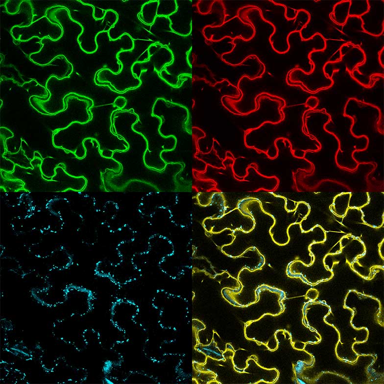 Intracellular localization of membrane proteins