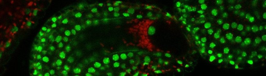 Fluorescence microscopy